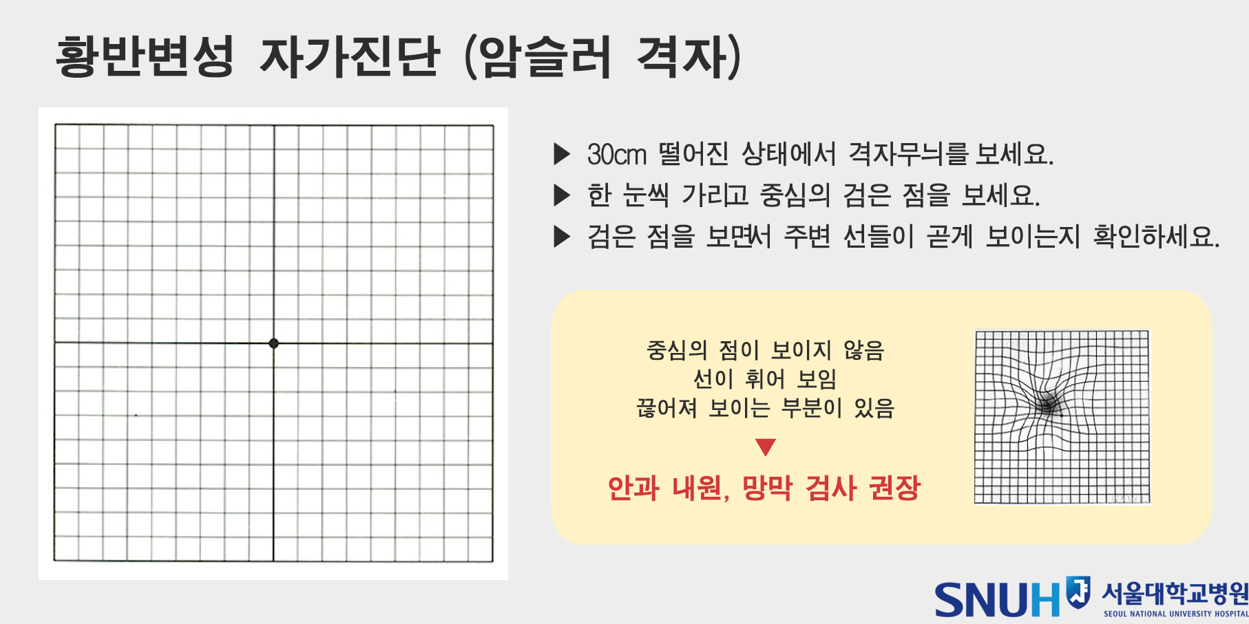 자가진단