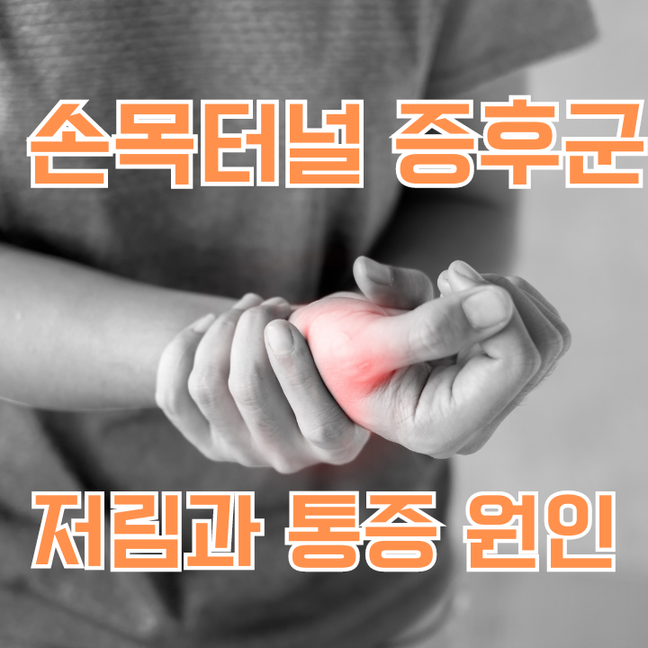 손목터널 증후군 